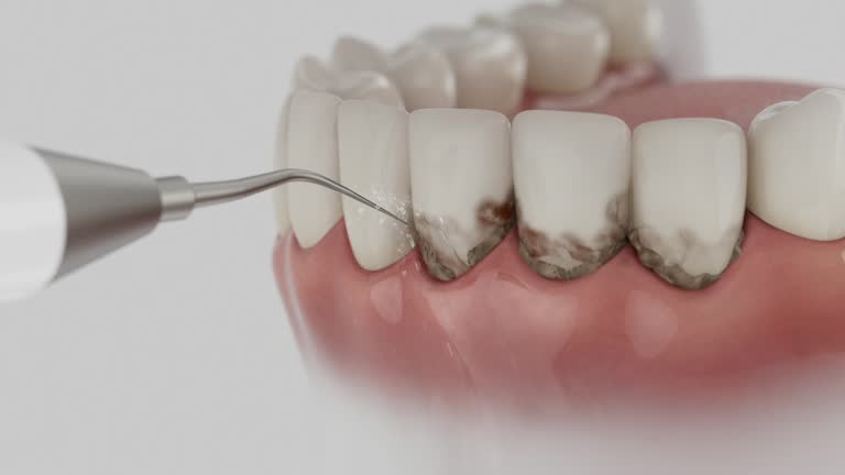 Trusted Tooth Extraction service in De Leon, TX - Dentist Open Now